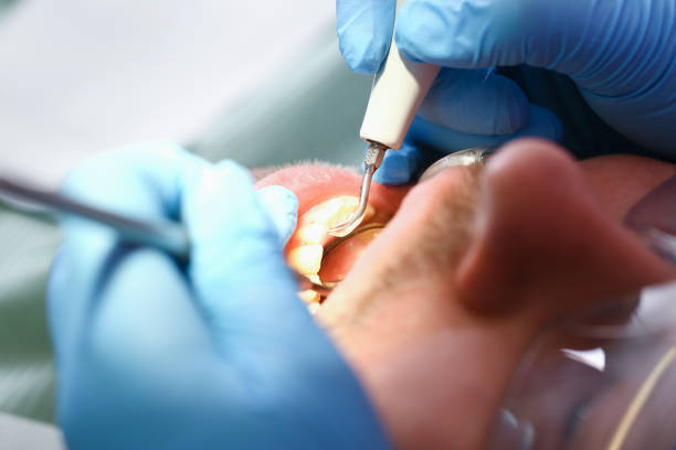 Best Emergency Orthodontic Services in Quincy, IL