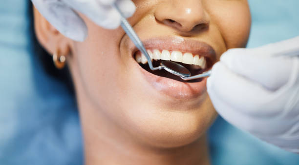 Best Cosmetic Emergency Dentistry in Quincy, IL