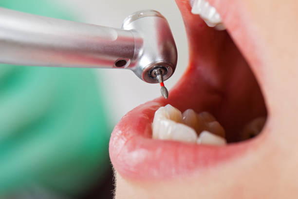 Best Emergency Denture Repair in Quincy, IL